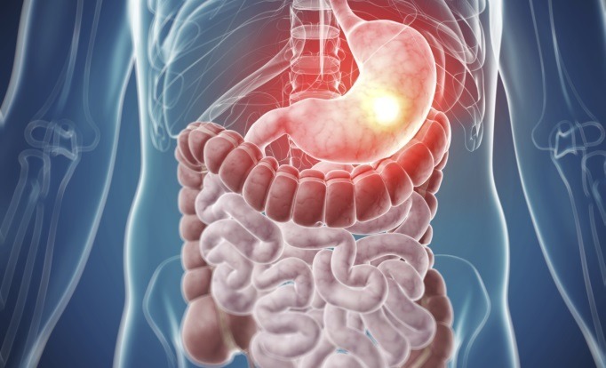 Best Gastrointestinal Cancer Treatment Specialist Pune, Pimpri Chinchwad PCMC