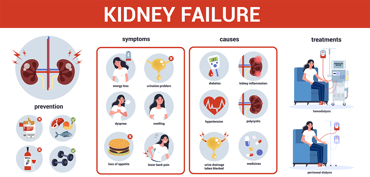 Kidney Cancer Symptoms Diagnosis And Treatment