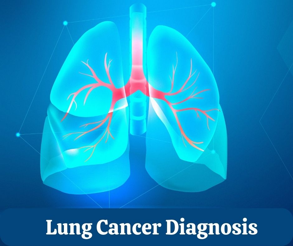 Lung Cancer Diagnosis