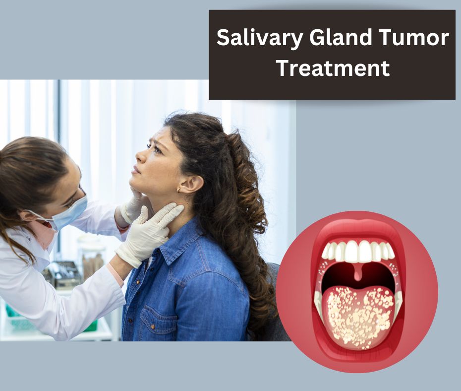 Salivary Gland tumor treatment | Dr. Ashish Pokharkar, Pune.