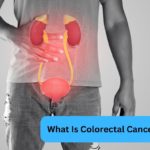 What Is Colorectal Cancer? | Dr. Ashish Pokharkar