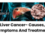 liver cancer treatment-Cancer surgery Pune-Dr. ashish pokharkar
