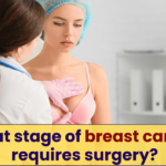 What stage of breast cancer requires surgery?